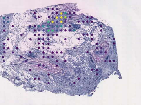 Human breast preview