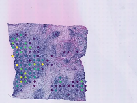 Human breast preview