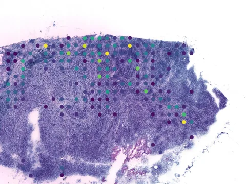 Human breast preview