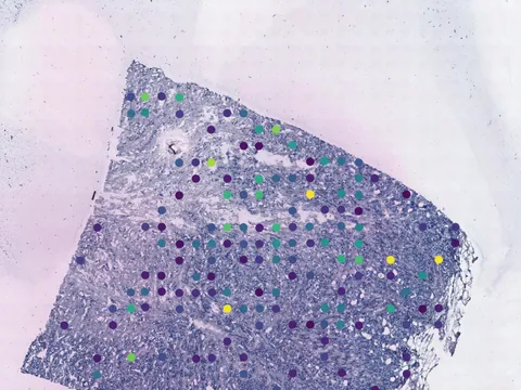 Human breast preview