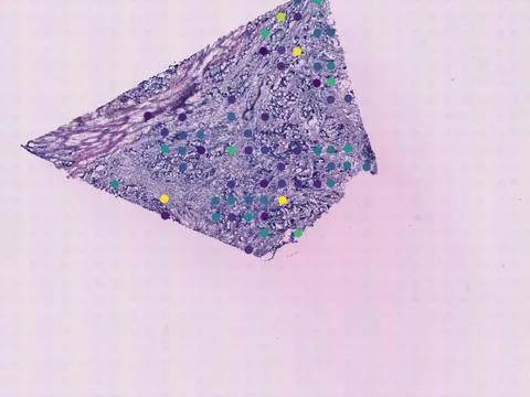 Human breast preview