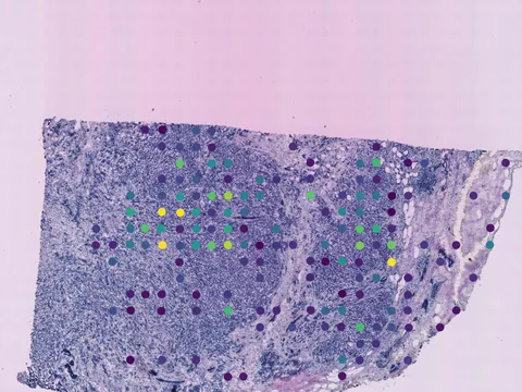 Human breast preview