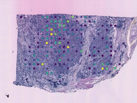 Human breast preview