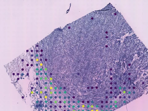 Human breast preview