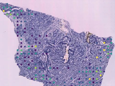 Human breast preview