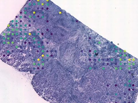 Human breast preview