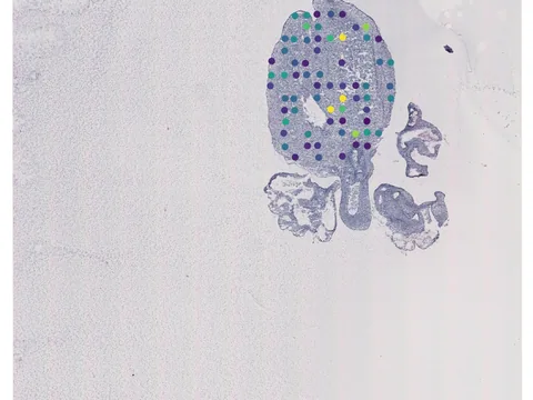 Human heart preview