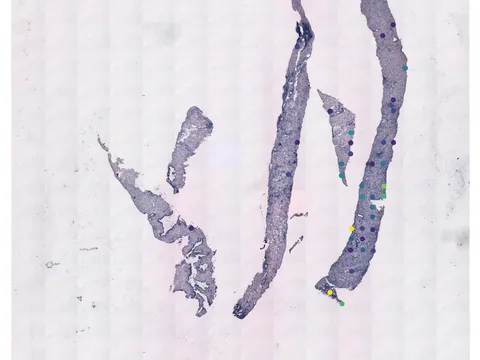 Human prostate gland preview