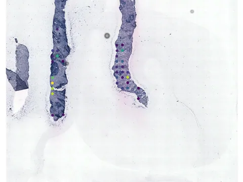 Human prostate gland preview