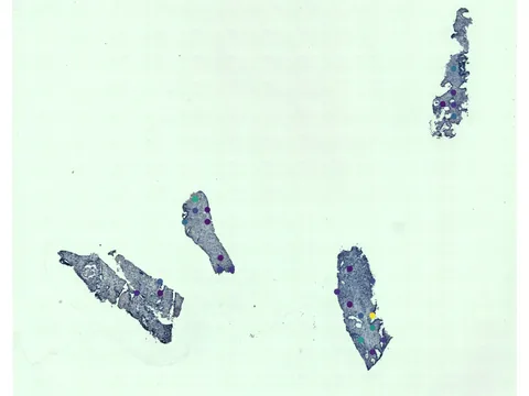 Human prostate gland preview
