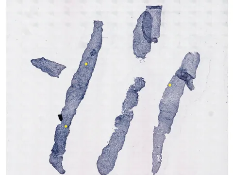 Human prostate gland preview