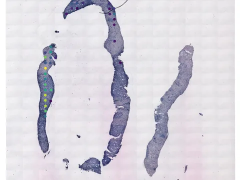 Human prostate gland preview