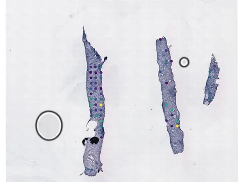 Human prostate gland preview
