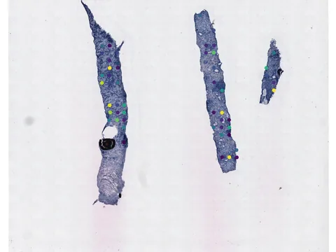 Human prostate gland preview