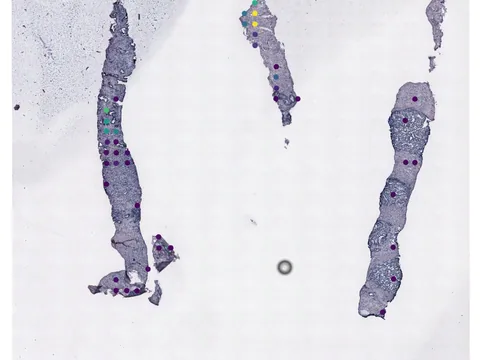 Human prostate gland preview