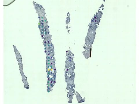 Human prostate gland preview
