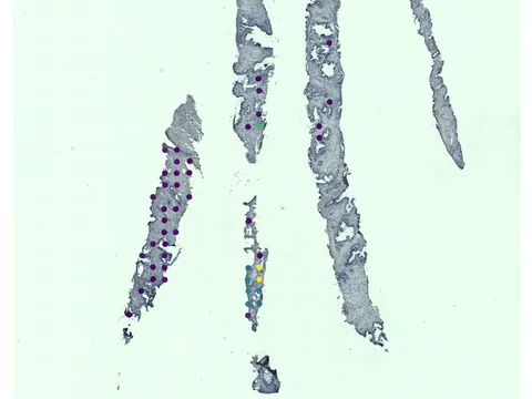 Human prostate gland preview