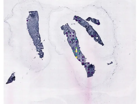 Human prostate gland preview
