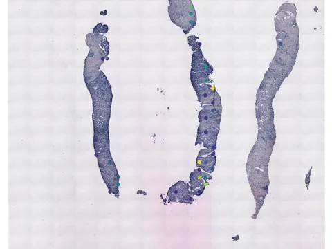 Human prostate gland preview