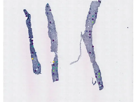 Human prostate gland preview