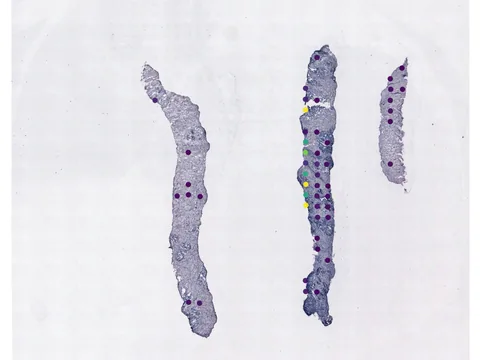 Human prostate gland preview