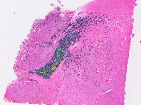 Human brain preview