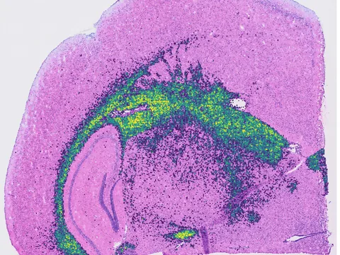 Mouse brain preview