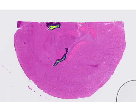 Mouse brain preview