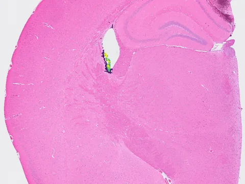 Mouse brain preview