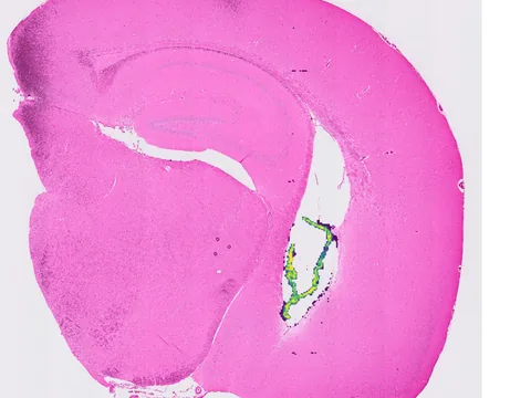 Mouse brain preview