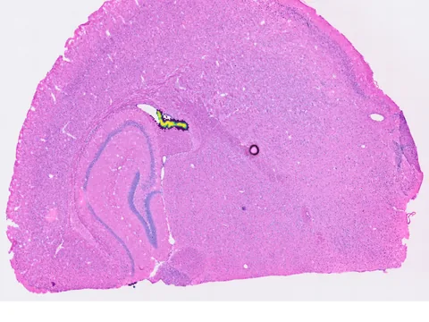 Mouse brain preview