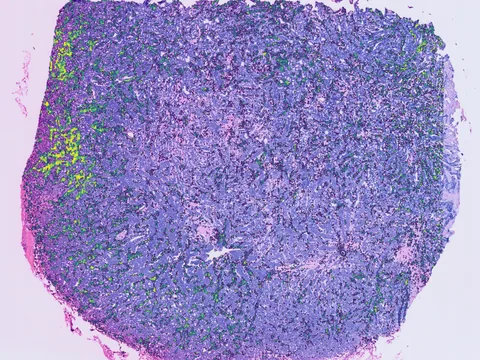 Human breast preview