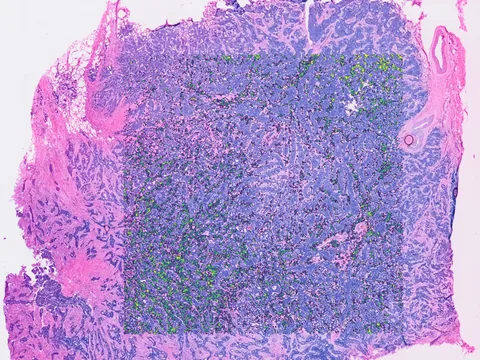 Human breast preview