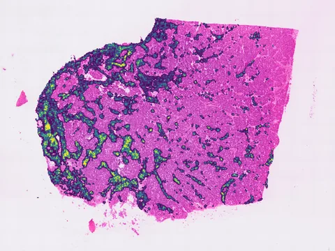 Human breast preview
