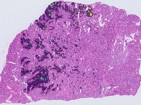 Human colon preview