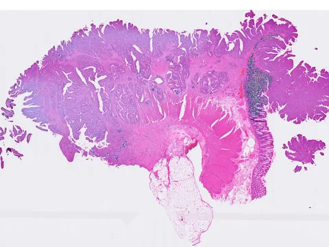 Human colon preview