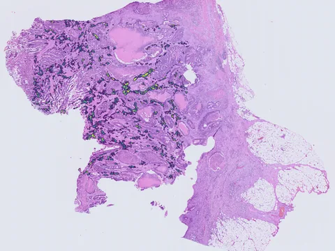 Human colon preview
