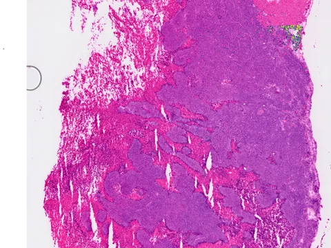 Mouse hypodermis preview