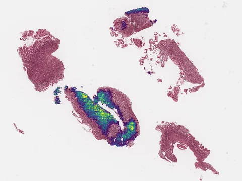 Human intestine preview