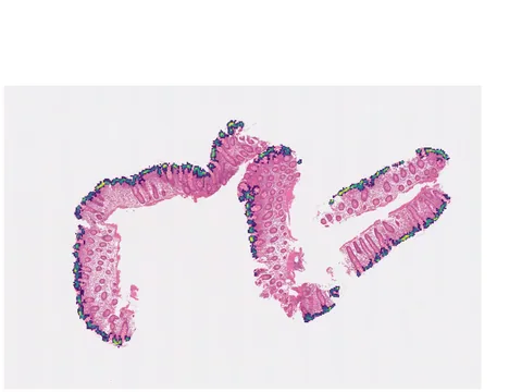 Human intestine preview