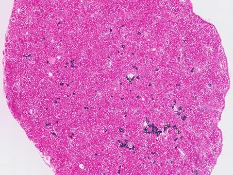 Human kidney preview