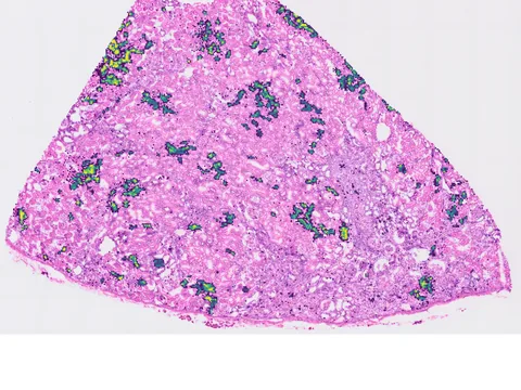Macaque kidney preview