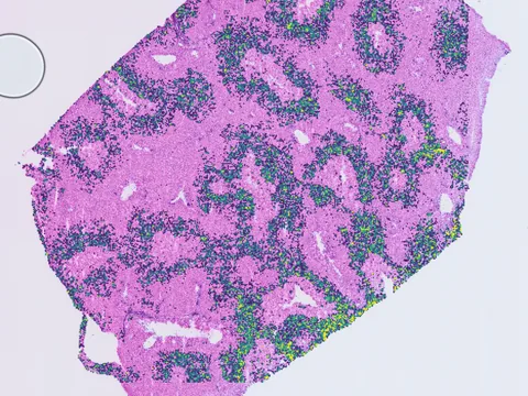 Macaque liver preview