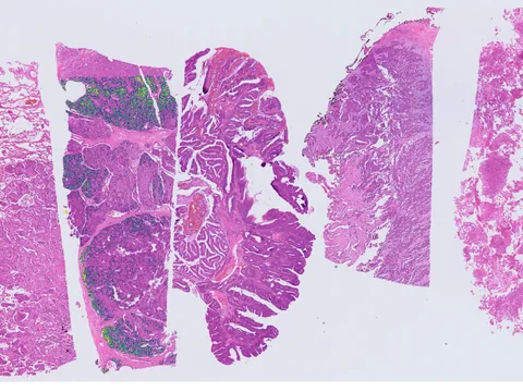 Human lung preview