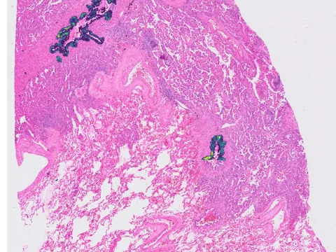 Human lung preview