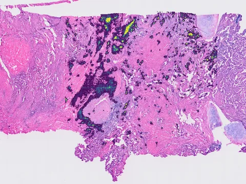 Human lung preview