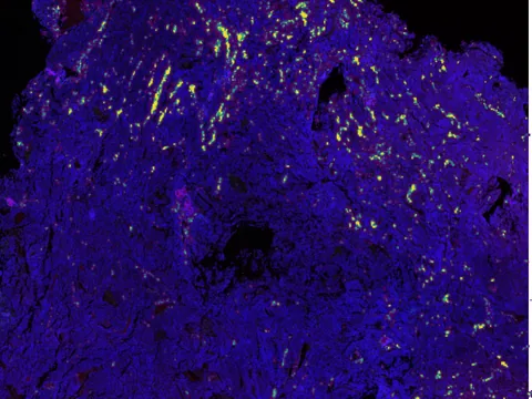 Human lung preview