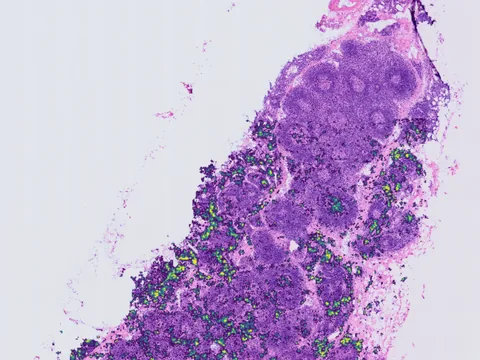 Human lymph node preview