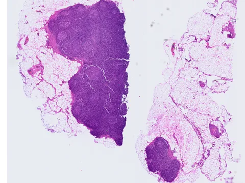 Human lymph node preview