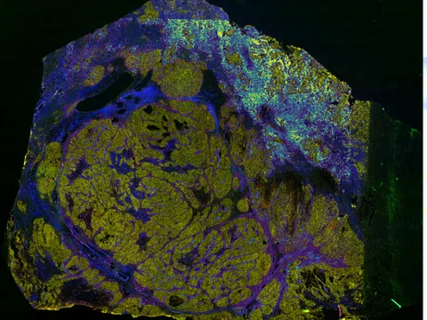 Human ovary preview